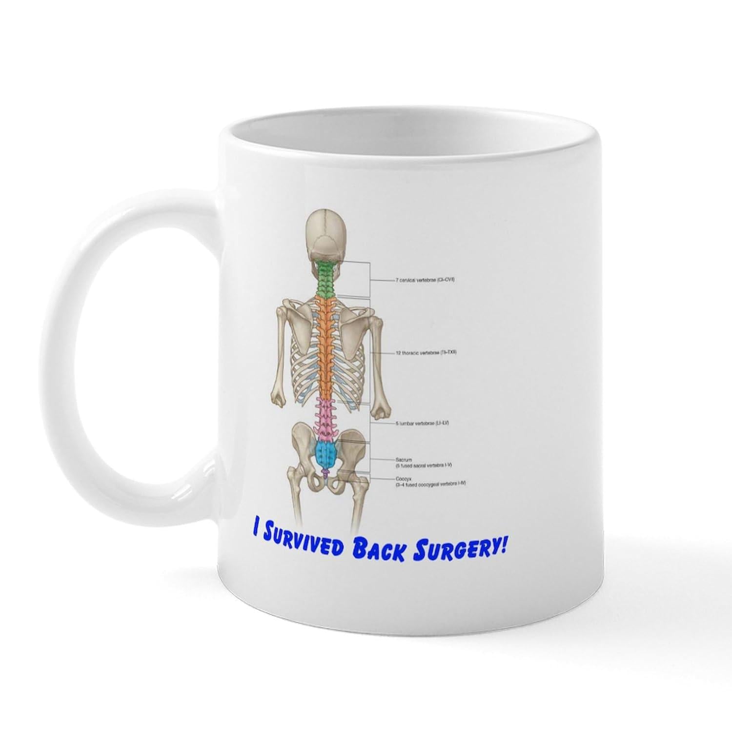 Tailorly White Ceramic 11 oz Mug - I Survived Back Surgery Detailed Medical Diagram Showing Colorful Spinal Sections On A Pristine Skeleton
